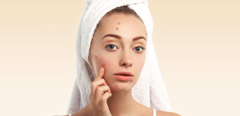 Acneea la adulți: De ce continuă să apară și cum poți scăpa de ea?